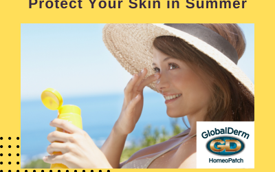 How To Protect Your Skin in Summer